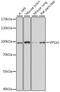 VPS16 Core Subunit Of CORVET And HOPS Complexes antibody, A06384, Boster Biological Technology, Western Blot image 