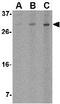 ORAI Calcium Release-Activated Calcium Modulator 2 antibody, GTX85443, GeneTex, Western Blot image 
