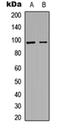 Aggrecan antibody, orb234991, Biorbyt, Western Blot image 