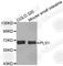 Plastin 1 antibody, A3626, ABclonal Technology, Western Blot image 