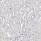 Actin Like 7B antibody, NBP1-86972, Novus Biologicals, Immunohistochemistry paraffin image 