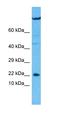 Ubiquitously Expressed Prefoldin Like Chaperone antibody, orb330521, Biorbyt, Western Blot image 