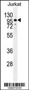 Zinc Finger Protein 841 antibody, 55-871, ProSci, Western Blot image 