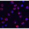 Transient Receptor Potential Cation Channel Subfamily C Member 6 antibody, LS-C19628, Lifespan Biosciences, Immunofluorescence image 