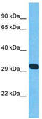 Adenylate Kinase 8 antibody, TA338875, Origene, Western Blot image 