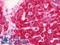 Malate Dehydrogenase 2 antibody, LS-B10823, Lifespan Biosciences, Immunohistochemistry paraffin image 