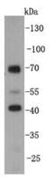 Kelch Domain Containing 3 antibody, NBP2-66919, Novus Biologicals, Western Blot image 