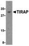 TIR Domain Containing Adaptor Protein antibody, MBS151462, MyBioSource, Western Blot image 