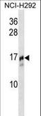 Trafficking Protein Particle Complex 2 antibody, LS-C160166, Lifespan Biosciences, Western Blot image 