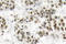 Mitogen-Activated Protein Kinase 8 antibody, LS-C177678, Lifespan Biosciences, Immunohistochemistry paraffin image 
