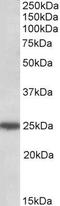 Rho GDP Dissociation Inhibitor Gamma antibody, GTX88058, GeneTex, Western Blot image 