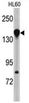 Nucleoporin 155 antibody, AP17603PU-N, Origene, Western Blot image 
