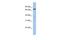 TCF11 antibody, GTX77762, GeneTex, Western Blot image 