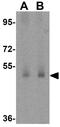 Major Facilitator Superfamily Domain Containing 1 antibody, GTX85148, GeneTex, Western Blot image 