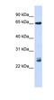 Tripartite Motif Containing 8 antibody, orb324811, Biorbyt, Western Blot image 
