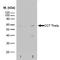 Chaperonin Containing TCP1 Subunit 8 antibody, GTX75920, GeneTex, Western Blot image 