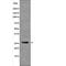 Cyclin Dependent Kinase Inhibitor 1B antibody, abx149166, Abbexa, Western Blot image 