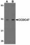 Coiled-Coil Domain Containing 47 antibody, LS-B4623, Lifespan Biosciences, Western Blot image 