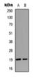 Stathmin 1 antibody, orb393172, Biorbyt, Western Blot image 