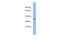 Pregnancy Specific Beta-1-Glycoprotein 5 antibody, ARP42068_P050, Aviva Systems Biology, Western Blot image 