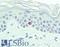 CD207 Molecule antibody, LS-B15833, Lifespan Biosciences, Immunohistochemistry paraffin image 