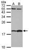 Fatty Acid Binding Protein 7 antibody, LS-C155660, Lifespan Biosciences, Western Blot image 