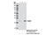 Ras-related protein Rab-25 antibody, 13048T, Cell Signaling Technology, Western Blot image 