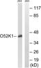Olfactory Receptor Family 52 Subfamily K Member 1 antibody, GTX87699, GeneTex, Western Blot image 