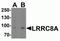 Leucine Rich Repeat Containing 8 VRAC Subunit A antibody, NBP2-81855, Novus Biologicals, Western Blot image 