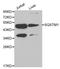 GATA Binding Protein 3 antibody, LS-C192252, Lifespan Biosciences, Western Blot image 