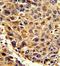 Signal Peptidase Complex Subunit 3 antibody, GTX81778, GeneTex, Immunohistochemistry paraffin image 