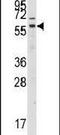 G Protein-Coupled Receptor Kinase 7 antibody, PA5-14807, Invitrogen Antibodies, Western Blot image 