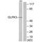 Putative glycerol kinase 3 antibody, A15189, Boster Biological Technology, Western Blot image 