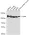 Cartilage Oligomeric Matrix Protein antibody, GTX33106, GeneTex, Western Blot image 