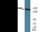 Glutamate Ionotropic Receptor NMDA Type Subunit 2B antibody, EKC2599, Boster Biological Technology, Western Blot image 