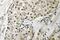 RB Transcriptional Corepressor 1 antibody, LS-C177771, Lifespan Biosciences, Immunohistochemistry paraffin image 