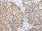 C-Terminal Binding Protein 1 antibody, CSB-PA572404, Cusabio, Immunohistochemistry paraffin image 