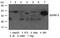 Insulin Like Growth Factor Binding Protein 3 antibody, GTX50853, GeneTex, Western Blot image 