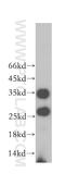 Serine Protease 2 antibody, 15005-1-AP, Proteintech Group, Western Blot image 