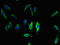 Transmembrane Protein 68 antibody, LS-C394831, Lifespan Biosciences, Immunofluorescence image 