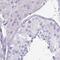Chloride Channel Accessory 1 antibody, NBP2-49060, Novus Biologicals, Immunohistochemistry paraffin image 