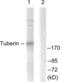 TSC Complex Subunit 2 antibody, LS-C117723, Lifespan Biosciences, Western Blot image 