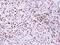 RecQ Like Helicase antibody, PA5-27099, Invitrogen Antibodies, Immunohistochemistry frozen image 