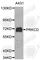 Protein Kinase C Delta antibody, A0959, ABclonal Technology, Western Blot image 