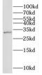 Nicotinamide Nucleotide Adenylyltransferase 1 antibody, FNab05767, FineTest, Western Blot image 