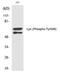 LYN Proto-Oncogene, Src Family Tyrosine Kinase antibody, PA5-40240, Invitrogen Antibodies, Western Blot image 