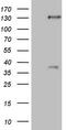 Sterol Regulatory Element Binding Transcription Factor 2 antibody, M01678, Boster Biological Technology, Western Blot image 