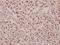 Gamma-Aminobutyric Acid Type A Receptor Gamma1 Subunit antibody, A08825, Boster Biological Technology, Immunohistochemistry frozen image 