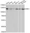 Staphylococcal Nuclease And Tudor Domain Containing 1 antibody, A13415, ABclonal Technology, Western Blot image 