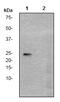 Eukaryotic Translation Initiation Factor 4E antibody, ab76256, Abcam, Western Blot image 